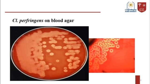 Clostridium perfringens Bacillus anthracis. 1 смотреть онлайн