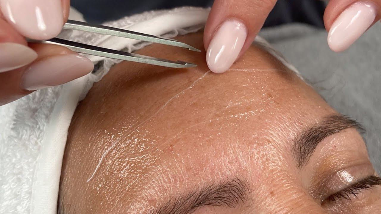 Ošetření Derma-Age pro regeneraci pleti a okamžitý lifting💖 #beautyspa #lifting #antiaging #plet смотреть онлайн
