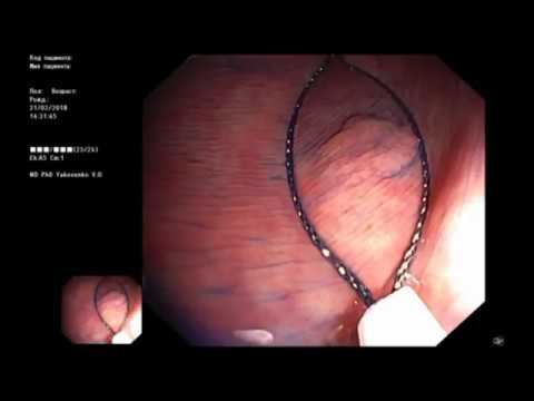 Where is the lesion? смотреть онлайн