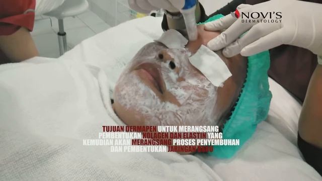Dermapen Teknik Perawatan Wajah Untuk Mengatasi Kulit Yang Kusam | NOVI'S Dermatology смотреть онлайн