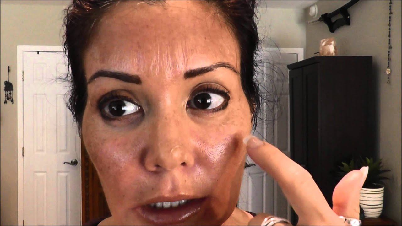 Perfect Derma Peel Day 4