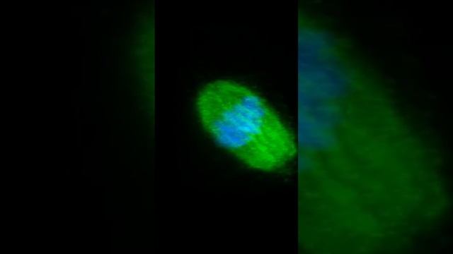 Meiotic Spindle essential structure of oocyte. смотреть онлайн