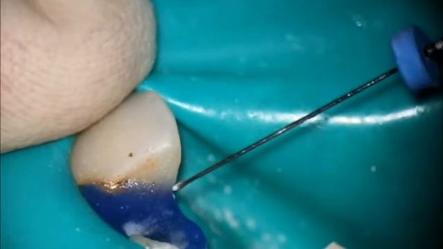 3D apex.wmv смотреть онлайн
