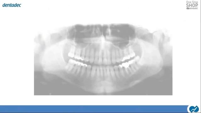 550 Avances en Radiología, en base a la Tecnología Digital смотреть онлайн