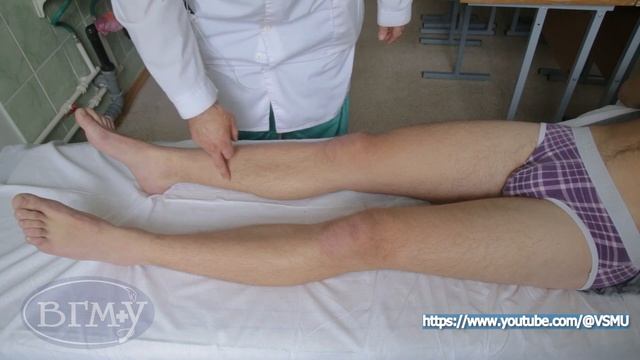 Проекция большой подкожной вены смотреть онлайн