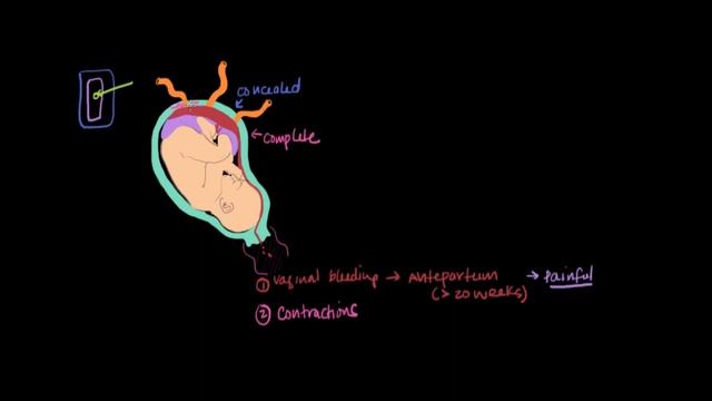 Placental Abruption | Reproductive System Physiology | NCLEX-RN | Khan Academy