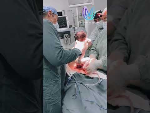 cesarea respetada смотреть онлайн
