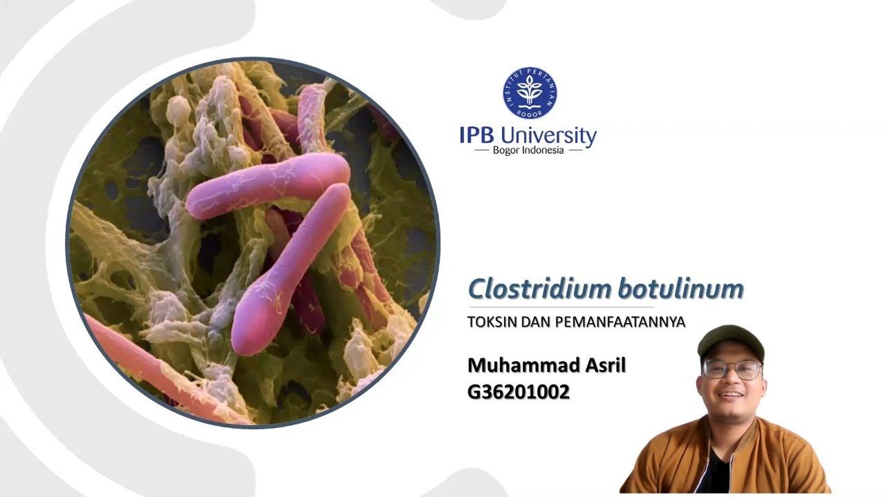 Bakteri Penganggu Saraf dan Otot (Clostridium botulinum) dapat Mencegah Kerutan?? смотреть онлайн