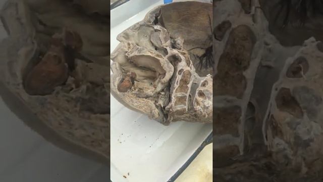 Digestive system. Hard and soft palate. Salivary glands. Pharynx. Esophagus смотреть онлайн