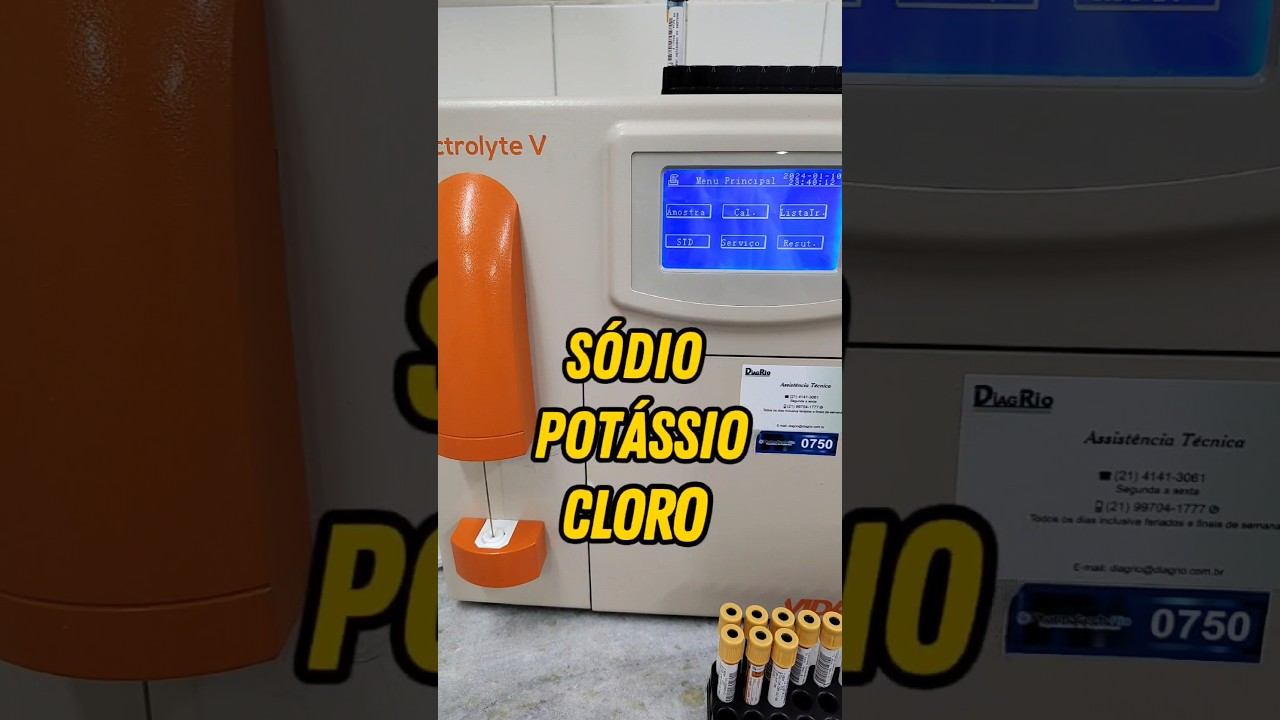 ELETROLYTE V - Exame de sódio, potássio e cloro #bioquímica #lab #examedesangue смотреть онлайн