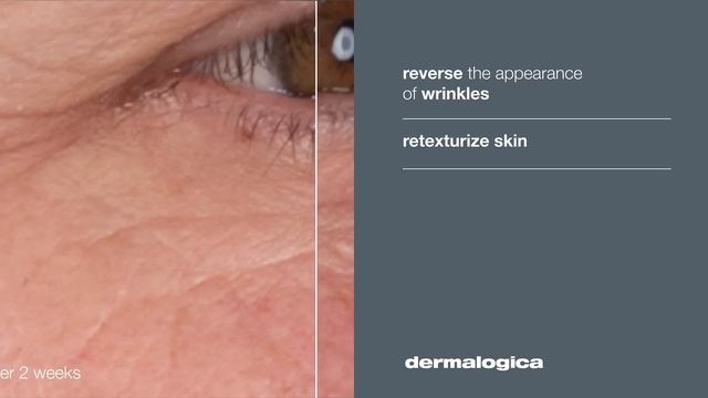 Dynamic Skin Retinol Serum смотреть онлайн