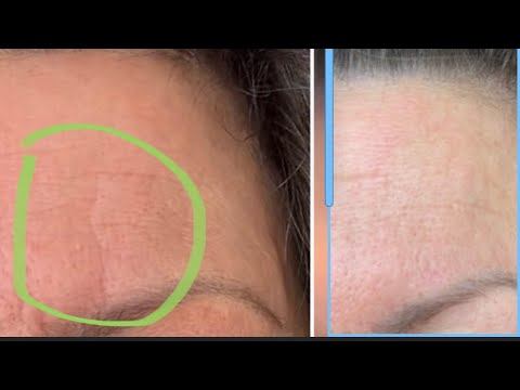 SLEEP SETTING Your Lines ? Don’t ! 2023 BEAUTY Sleep смотреть онлайн