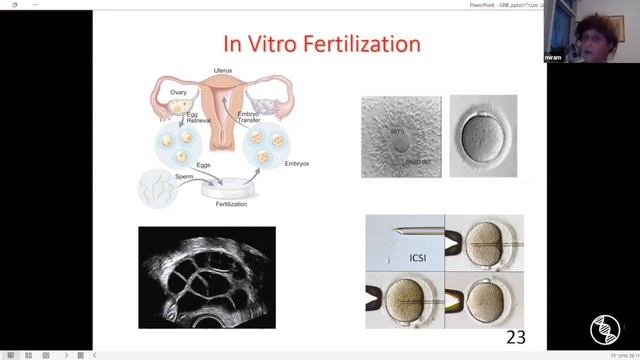 2023 NDF GNEM Speaker Series: Dr. Mira Malcov, Navigating Genetic Counseling and IVF Solutions смотреть онлайн
