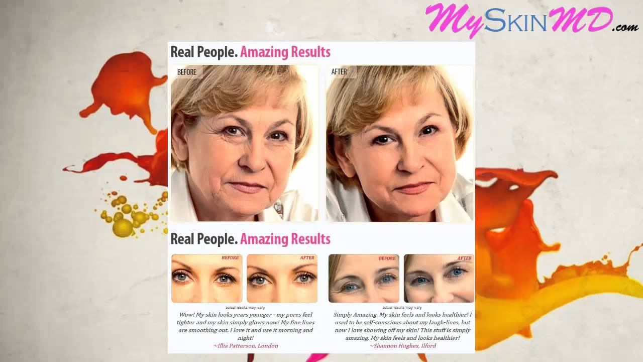 Juvesiio Anti-Wrinkle Serum Review - Reveals The Secret To Look Many Years Younger смотреть онлайн