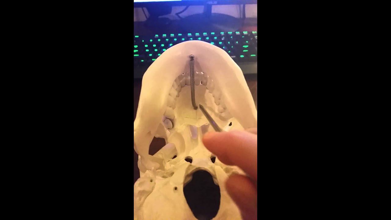 Maxilla смотреть онлайн