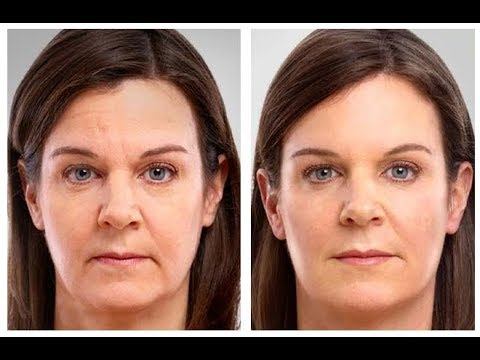 California Bioenergy Skin Care Review | HealthLione смотреть онлайн