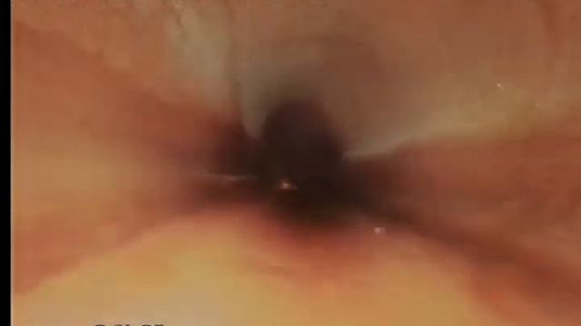 529 Corte Amino 04/30/2021 смотреть онлайн