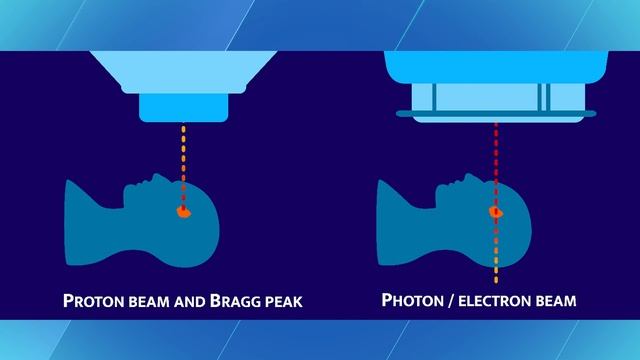 The Science Behind Proton Therapy смотреть онлайн