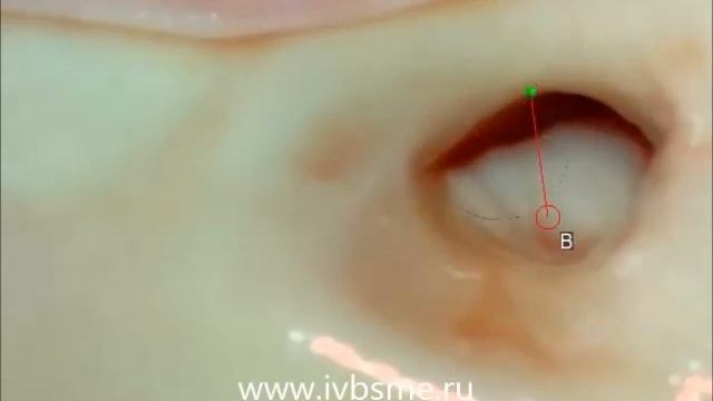 Иллюзия. 3D загадка 4. Какая часть тела? смотреть онлайн