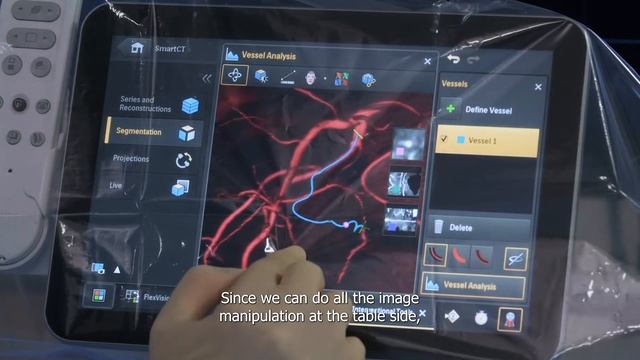 Philips Azurion with SmartCT - first user experiences смотреть онлайн