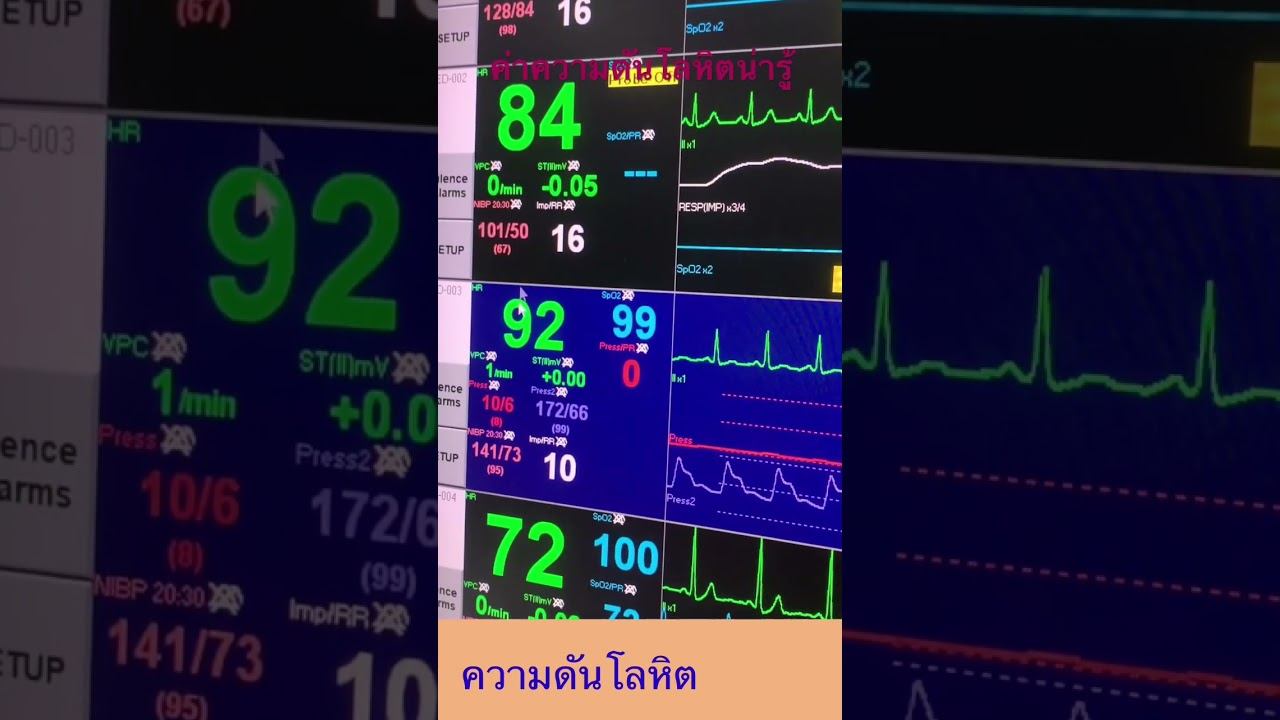 ค่าความดันโลหิตน่ารู้ ความดันโลหิตปกติเท่าไหร่ смотреть онлайн