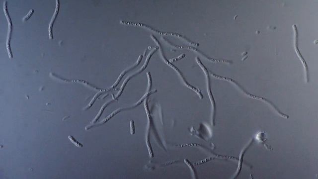 Bacteria Spirillum - DIC microscope 1000x смотреть онлайн