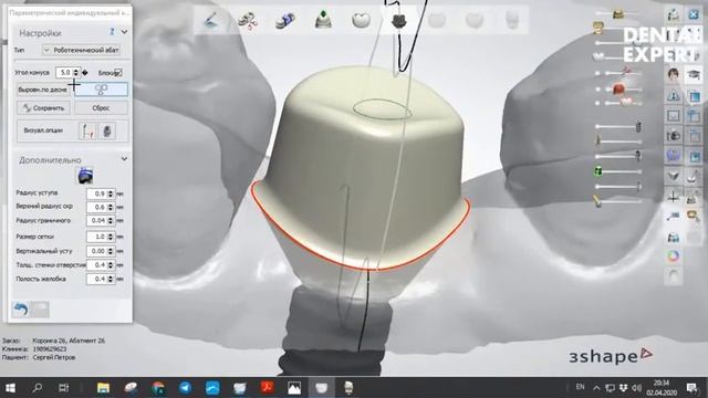 Основы моделирования в 3shape смотреть онлайн