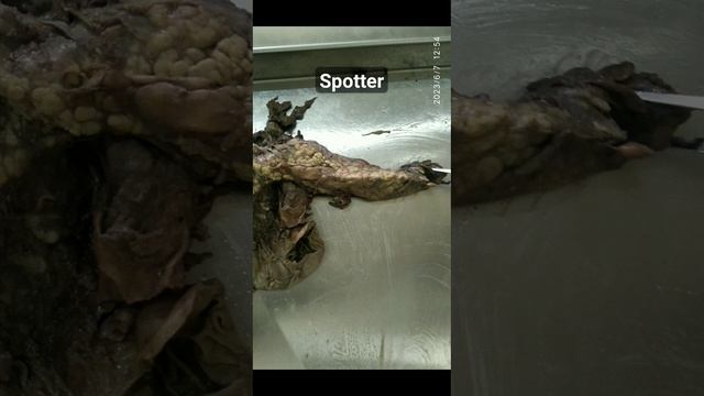 Pancreas 4 #logicmedico #anatomy смотреть онлайн