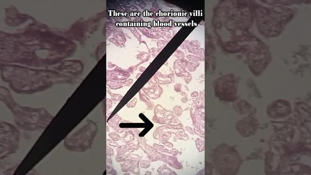 Placenta Histology смотреть онлайн
