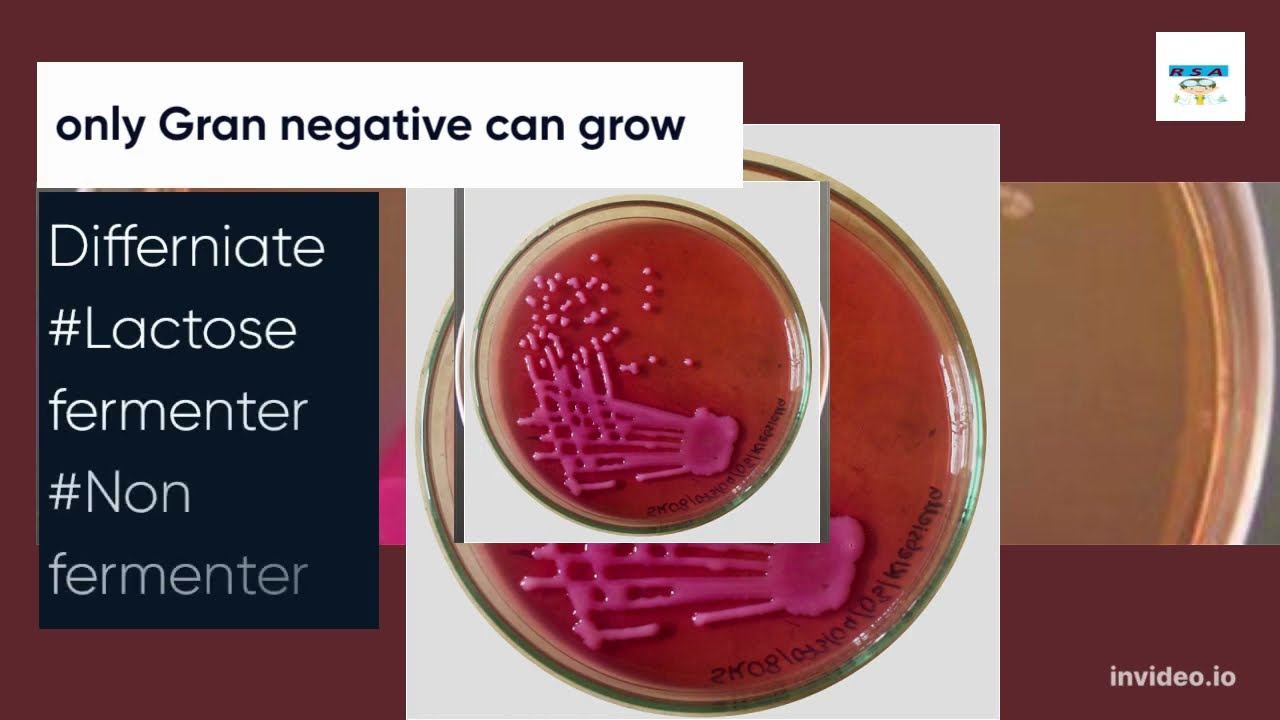 MacConkey Agar: A Versatile Medium for Microbial Culture and Identification смотреть онлайн