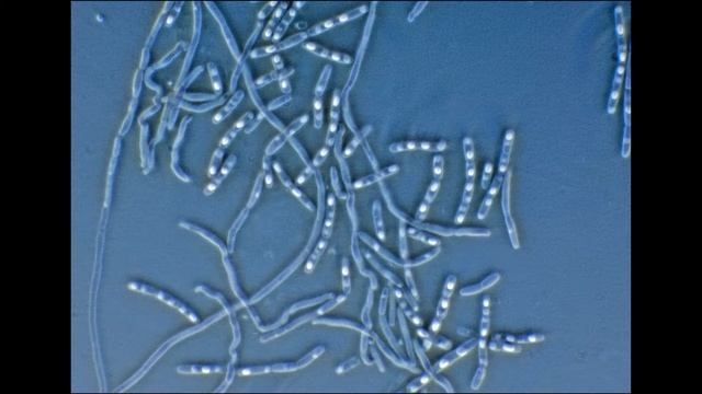 Bt - Bacillus thuringiensis смотреть онлайн