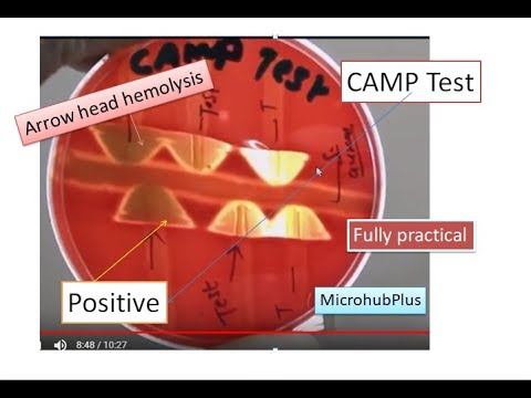 CAMP test |CAMP Factor | CAMP Reaction | Microbiology |Streptococcus agalactiae смотреть онлайн