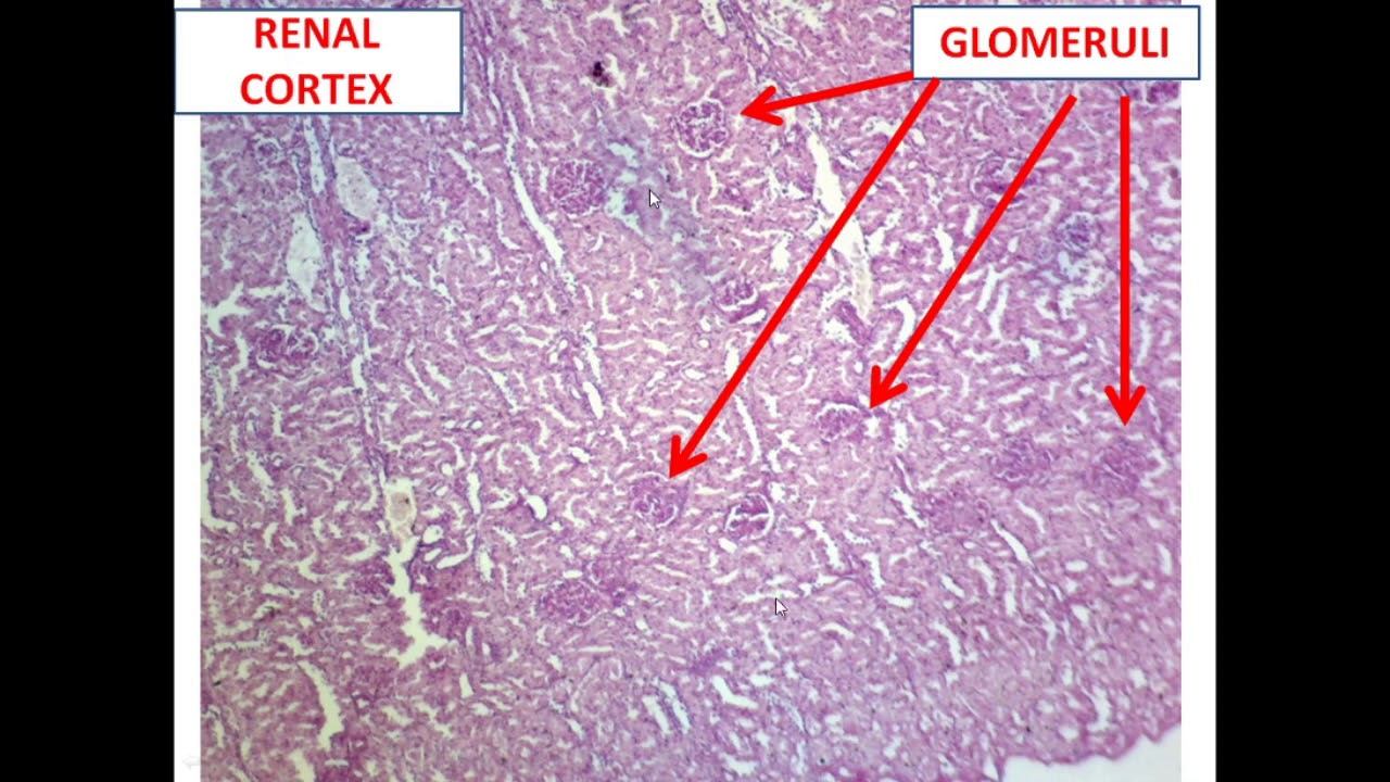 HISTOLOGY OF URINARY SYSTEM смотреть онлайн