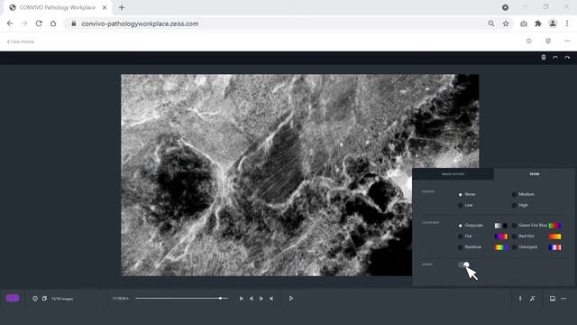 How to process and annotate confocal images - ZEISS CONVIVO In Vivo Pathology Suite смотреть онлайн