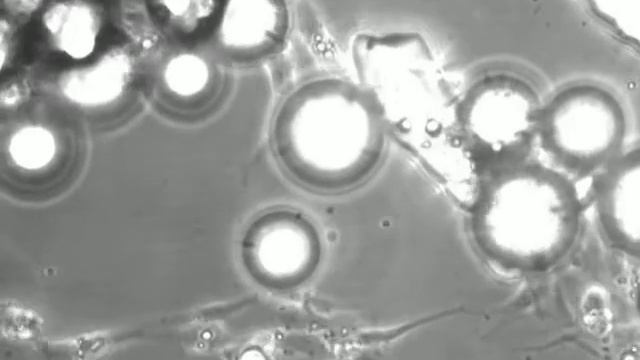 Randomly Seeded HUVEC and 50 micron glass beads 100 mins timelapse 32x obj смотреть онлайн