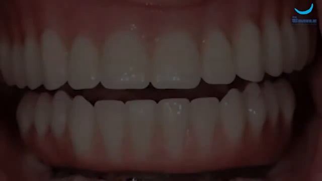 Имплантация и протезирование врач Бутаев А.С. Клиника (Dr. Smile) смотреть онлайн