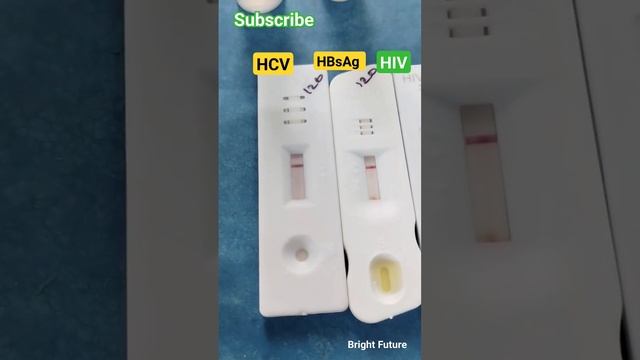 Viral marker test | Hepatitis B, Hepatitis C, HIV #medicallaboratory #microbiology смотреть онлайн