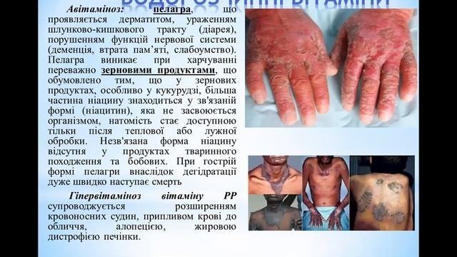 Вітамін РР: теорія + тести КРОК 1/2 Біохімія. Гігієна. смотреть онлайн