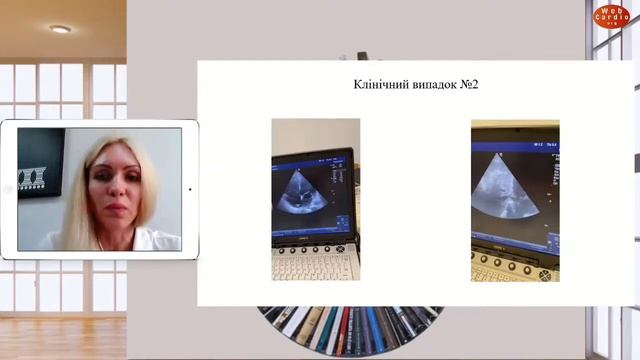 Механічна підтримка кровообігу у пацієнтів з термінальною серцевою недостатністю. Ольга Танська смотреть онлайн