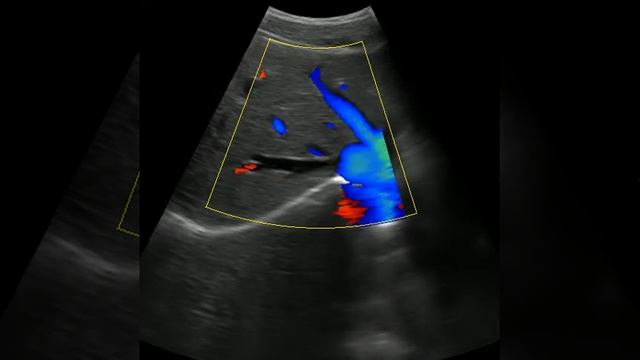 color doppler EW-C8 смотреть онлайн