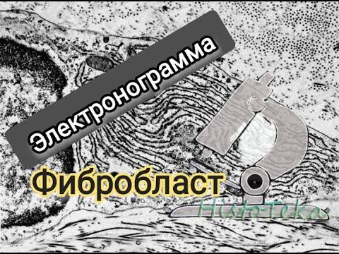 ФИБРОБЛАСТ (электронограмма) смотреть онлайн
