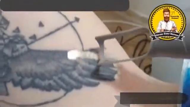 Pico Lazer ile etkili dövme silme işlemleri смотреть онлайн