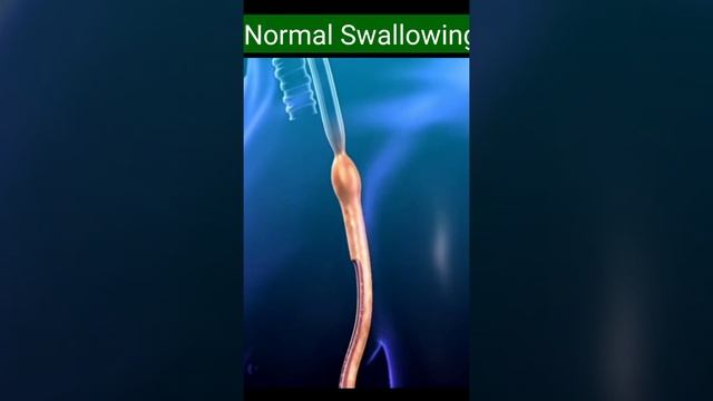 Swallowing смотреть онлайн