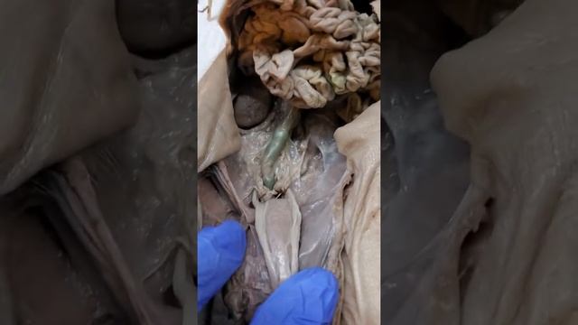 Urinary/ Urethra Section Pig Dissection смотреть онлайн