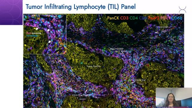 Deep Profiling and Spatial Characterization of Tumor Microenvironment TME Using Hyperplex Immunoflu смотреть онлайн