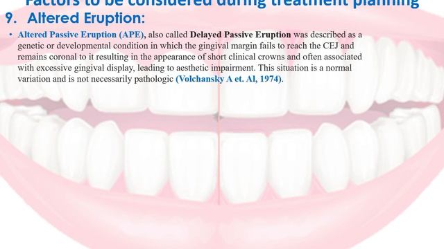 Crown Lengthening. Dr. Khalid Azouni смотреть онлайн