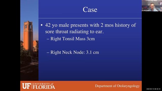 TORS for Oropharyngeal Cancer - Dr. Peter Dz смотреть онлайн