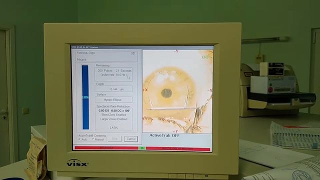 Olga femto lasik surgery смотреть онлайн
