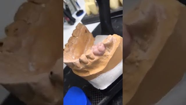 waxup (моделирование зуба из воска) смотреть онлайн