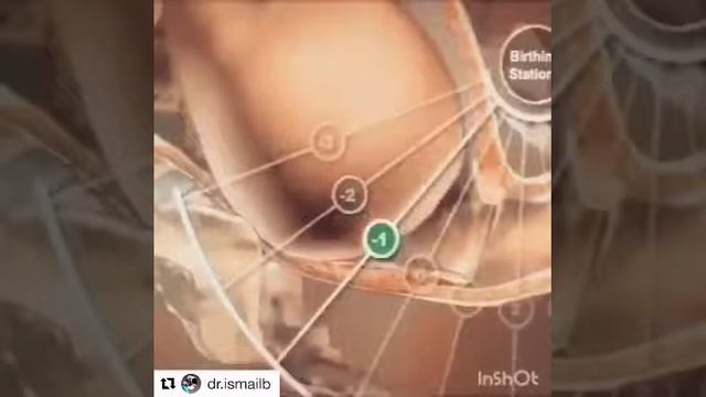 Университетный улыбка